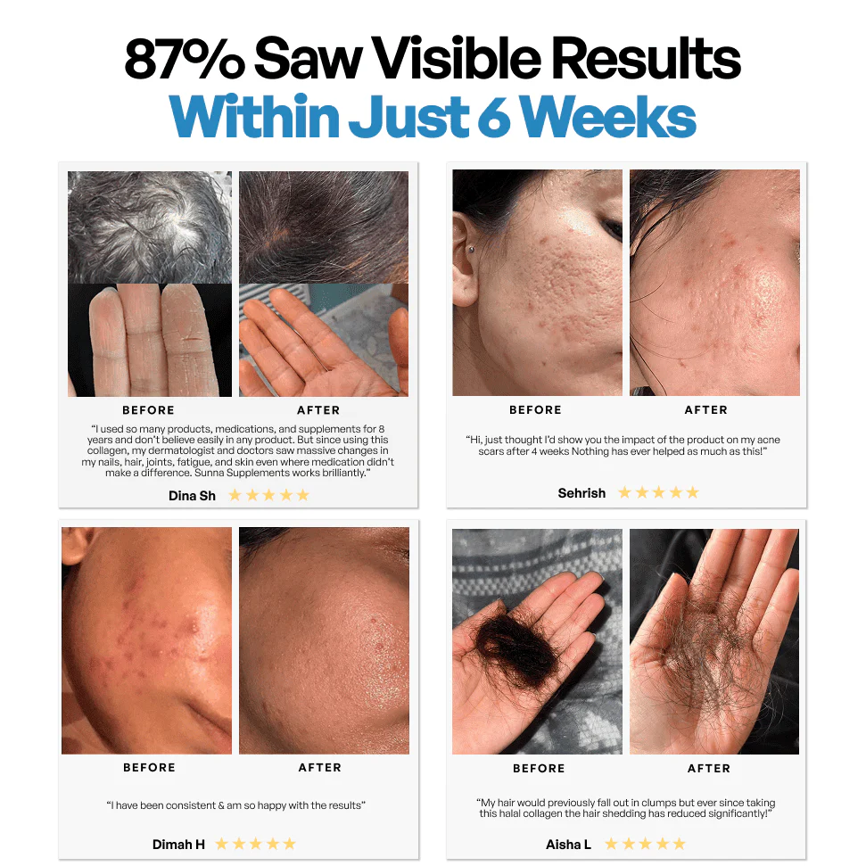 Collagen 3 Month Supply (750g) - Image 3